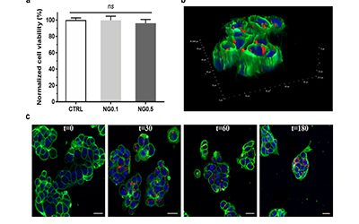 Nano-encapsulation of hydroxytyrosol into formulated nanogels improves therapeutic effects against hepatic steatosis: An in vitro study